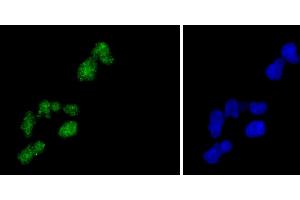 HeLa cells were fixed in paraformaldehyde, permeabilized with 0. (H2AFZ Antikörper)