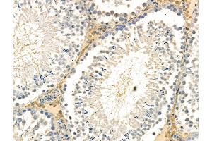 Phospho-ID2 (Thr27) Antibody at 1/100 staining Rat testis tissue by IHC-P.