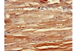 Immunohistochemistry of paraffin-embedded human skeletal muscle tissue using ABIN7145708 at dilution of 1:100 (BMPR1B Antikörper  (AA 14-126))