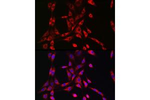 Immunofluorescence analysis of NIH/3T3 cells using PIK3R4/VPS15 Rabbit pAb (ABIN7269323) at dilution of 1:50 (40x lens). (PIK3R4 Antikörper  (AA 1-330))