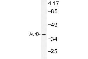 Image no. 1 for anti-Aurora Kinase B (AURKB) antibody (ABIN272096) (Aurora Kinase B Antikörper)