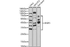 Western blot analysis of extracts of various cell lines, using BNIP3 antibody (ABIN6127502, ABIN6137620, ABIN6137621 and ABIN6221337) at 1:1000 dilution. (BNIP3 Antikörper  (AA 1-164))