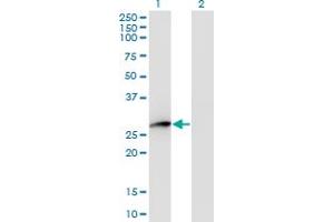 Western Blot analysis of HPGD expression in transfected 293T cell line by HPGD monoclonal antibody (M01), clone 1D8.