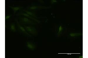 Immunofluorescence of monoclonal antibody to RNF125 on HeLa cell. (RNF125 Antikörper  (AA 143-231))
