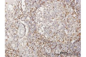 Immunoperoxidase of purified MaxPab antibody to CD2 on formalin-fixed paraffin-embedded human lymph node. (CD2 Antikörper  (AA 1-351))