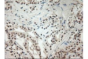 Immunohistochemical staining of paraffin-embedded Ovary tissue using anti-L1CAMmouse monoclonal antibody. (L1CAM Antikörper)