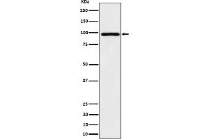Western blot analysis of AKAP 95 expression in HepG2 cell lysate. (Rekombinanter AKAP8 Antikörper)
