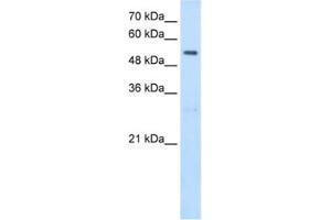 Western Blotting (WB) image for anti-serine Hydroxymethyltransferase 2 (Mitochondrial) (SHMT2) antibody (ABIN2462945)