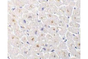 Immunohistochemical staining of DcR3 in human heart tissue with DcR3 antibody at 1μg/ml. (TNFRSF6B Antikörper)
