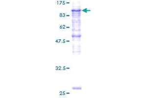 PLOD2 Protein (AA 27-758) (GST tag)