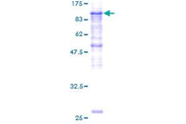 PLOD2 Protein (AA 27-758) (GST tag)