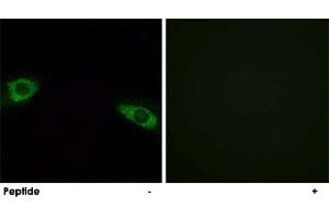 Immunofluorescence analysis of HUVEC cells, using RPS4Y1 polyclonal antibody . (RPS4Y1 Antikörper  (C-Term))