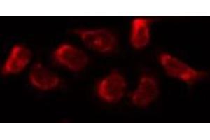 ABIN6269021 staining HUVEC by IF/ICC. (FSHR Antikörper  (Internal Region))