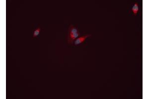 ABIN6261999 and ABIN6277813 staining HEPG2 cells by ICC/IF. (GLN1 Antikörper  (C-Term))