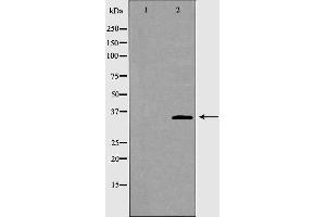 Western blot analysis of Mouse liver tissue lysates, using AKR1B1 Antibody.