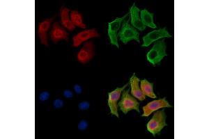 ABIN7094256 and ABIN7098303 staining HepG2 cells by IF/ICC.