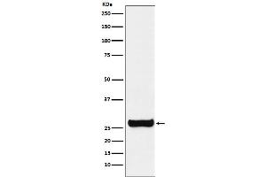 Western blot analysis of GSTM1 expression in SH-SY5Y cell lysate.
