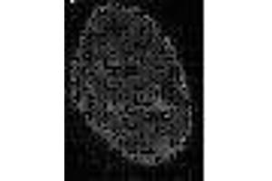 Immunofluorescence (IF) image for anti-Chromobox Homolog 3 (CBX3) (C-Term) antibody (ABIN2452035) (CBX3 Antikörper  (C-Term))