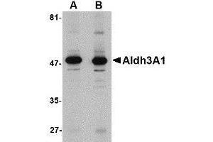 Western blot analysis of Aldh3A1 in human stomach lysate with AP30043PU-N Aldh3A1 antibody at (A) 1 and (B) 2 μg/ml. (ALDH3A1 Antikörper  (C-Term))