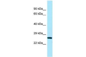 WB Suggested Anti-UQCC Antibody Titration: 1. (Ubiquinol-Cytochrome C Reductase Complex Chaperone (UQCC) (N-Term) Antikörper)