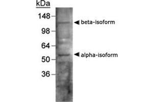 Western blot analysis of LXR in human liver using NR1H3/NR1H2 polyclonal antibody .