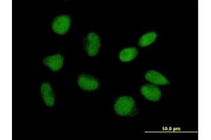 Immunofluorescence of purified MaxPab antibody to CGI-09 on HeLa cell. (TRMT6 Antikörper  (AA 1-497))