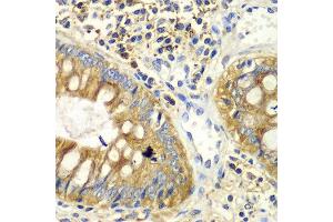 Immunohistochemistry of paraffin-embedded human colon using PICK1 antibody at dilution of 1:100 (x40 lens). (PICK1 Antikörper)