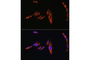 Immunofluorescence analysis of NIH/3T3 cells using A Rabbit pAb (ABIN6129944, ABIN6137377, ABIN6137378 and ABIN6224448) at dilution of 1:100.