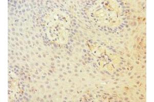 Immunohistochemistry of paraffin-embedded human tonsil tissue using ABIN7147204 at dilution of 1:100