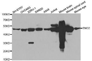 Western blot analysis of extracts of various cell lines, using ENO2 antibody. (ENO2/NSE Antikörper)