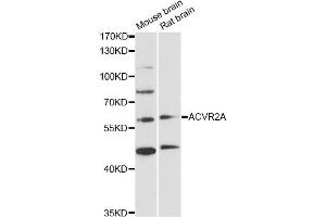 Western blot analysis of extracts of various cell lines, using ACVR2A antibody (ABIN5971030) at 1/1000 dilution. (ACVR2A Antikörper)