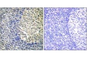 Immunohistochemistry analysis of paraffin-embedded human tonsil, using p47 phox (Phospho-Ser370) Antibody. (NCF1 Antikörper  (pSer370))