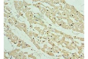 Immunohistochemistry of paraffin-embedded human heart tissue using ABIN7144071 at dilution of 1:100 (APC1 Antikörper  (AA 1-185))