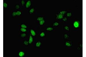 Immunofluorescent analysis of A549 cells using ABIN7150707 at dilution of 1:100 and Alexa Fluor 488-congugated AffiniPure Goat Anti-Rabbit IgG(H+L) (MAP2K3 Antikörper  (AA 1-347))