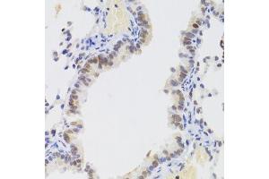 Immunohistochemistry of paraffin-embedded mouse lung using NASP Antibody. (NASP Antikörper  (AA 180-449))