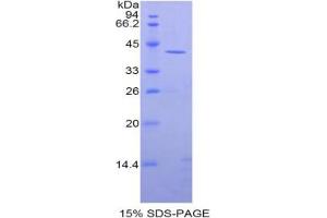 SDS-PAGE analysis of Rat CKM Protein. (CKM Protein)