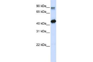 WB Suggested Anti-HMG20A Antibody Titration:  0. (HMG20A Antikörper  (N-Term))