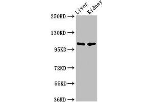 Western Blot Positive WB detected in: Rat liver tissue, Mouse kidney tissue All lanes: PEAR1 antibody at 5. (PEAR1 Antikörper  (AA 932-1037))