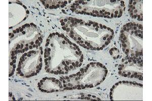 Image no. 21 for anti-Transducin-Like Enhancer of Split 1 (E(sp1) Homolog, Drosophila) (TLE1) (AA 180-460) antibody (ABIN1491049)