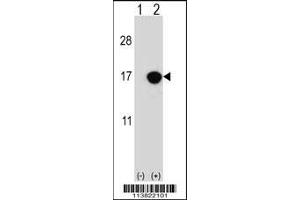 Western Blotting (WB) image for anti-Cyclin-Dependent Kinase Inhibitor 2B (p15, Inhibits CDK4) (CDKN2B) (AA 102-130), (C-Term) antibody (ABIN5534089)