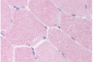 Human Skeletal Muscle (formalin-fixed, paraffin-embedded) stained with BARD1 antibody ABIN214634 at 10 ug/ml followed by biotinylated goat anti-rabbit IgG secondary antibody ABIN481713, alkaline phosphatase-streptavidin and chromogen. (BARD1 Antikörper  (AA 108-124))