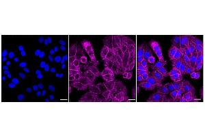 Immunocytochemical staining of HepG2 cells with Radixin antibody (ABIN7800123), 1:1,000).