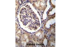 Immunohistochemistry (Paraffin-embedded Sections) (IHC (p)) image for anti-Aldo-Keto Reductase Family 1, Member C3 (3-alpha Hydroxysteroid Dehydrogenase, Type II) (AKR1C3) (AA 114-143), (Middle Region) antibody (ABIN950321)