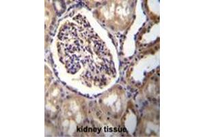AKR1C3 Antibody (Center) immunohistochemistry analysis in formalin fixed and paraffin embedded human kidney tissue followed by peroxidase conjugation of the secondary antibody and DAB staining. (AKR1C3 Antikörper  (Middle Region))