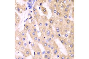 Immunohistochemistry (IHC) image for anti-Cytochrome P450, Family 3, Subfamily A, Polypeptide 4 (CYP3A4) (AA 244-503) antibody (ABIN3023346)