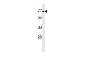 Western Blotting (WB) image for anti-Solute Carrier Family 7 (Cationic Amino Acid Transporter, Y+ System), Member 1 (SLC7A1) (AA 429-457), (C-Term) antibody (ABIN5534697)