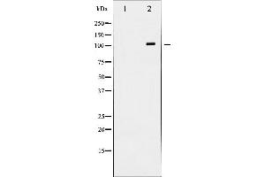 Western blot analysis of NMDAR1 expression in Jurkat whole cell lysates,The lane on the left is treated with the antigen-specific peptide. (GRIN1/NMDAR1 Antikörper  (C-Term))