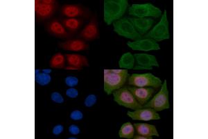 ABIN6263448 and ABIN6269128 staining Hela cells(45 min of heat-shock) by IF/ICC.