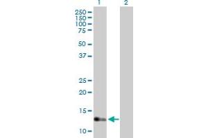 Western Blot analysis of IFT20 expression in transfected 293T cell line by IFT20 MaxPab polyclonal antibody. (IFT20 Antikörper  (AA 1-148))