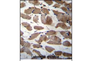 ACTN3 Antibody (Center) (ABIN656261 and ABIN2845575) immunohistochemistry analysis in formalin fixed and paraffin embedded human skeletal muscle followed by peroxidase conjugation of the secondary antibody and DAB staining.